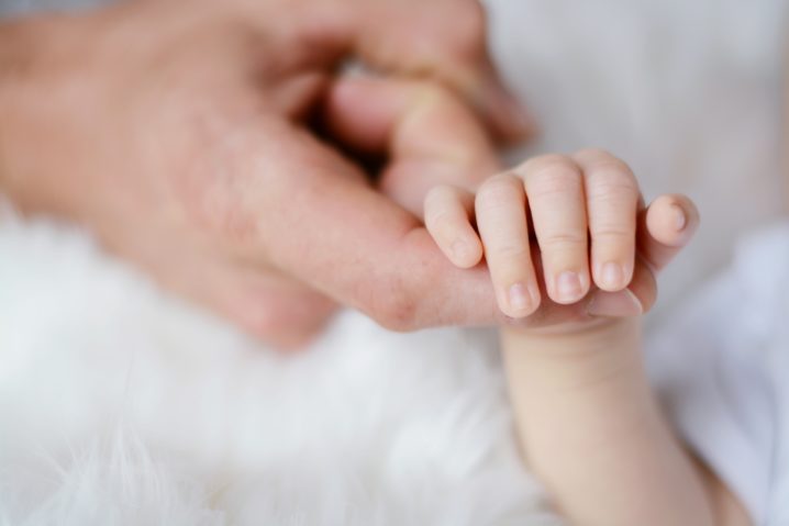 赤ちゃんが毛深いのは遺伝や病気 乳幼児の毛深さの原因と３つの対策 はじめてママ